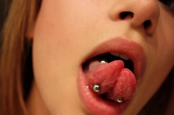 Tongue bifurcation