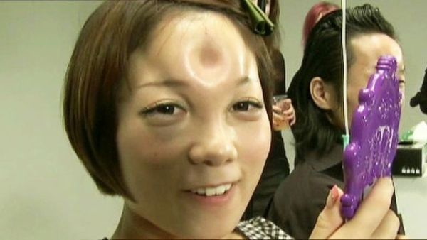 bagel shaped lump in the forehead